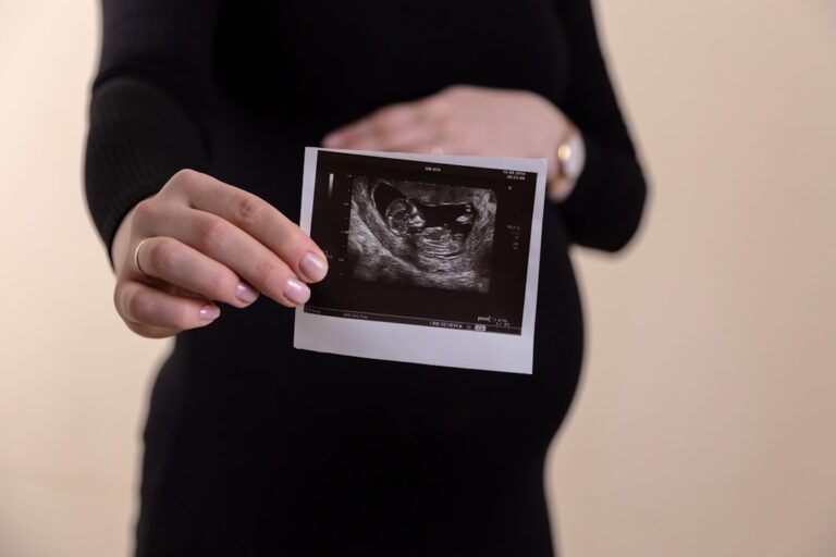 A pregnant woman lying on an exam table while a medical technician performs an abdominal ultrasound.