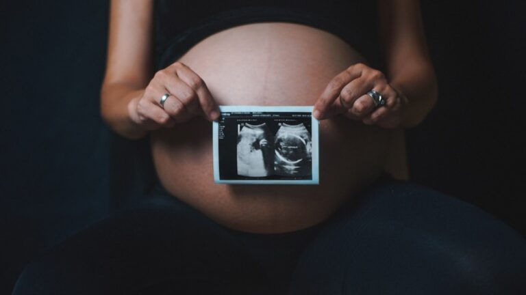 A person reviewing a printed ultrasound image in a well-lit home setting
