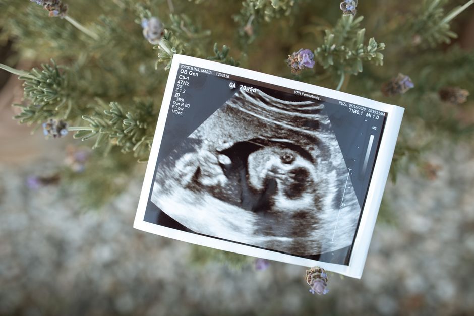 A pregnant person lying on an exam table during an abdominal ultrasound with a technician using a handheld probe.